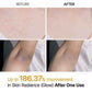 Kojic Acid Turmeric Body Scrub Spray: Deeply Cleanses