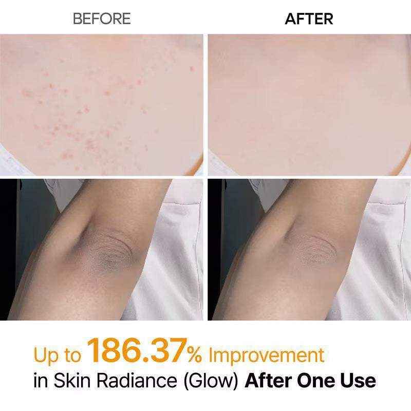 Kojic Acid Turmeric Body Scrub Spray: Deeply Cleanses