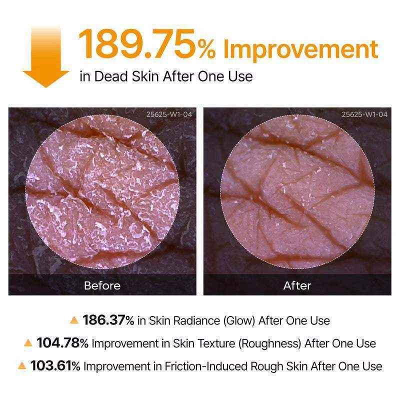 Kojic Acid Turmeric Body Scrub Spray: Deeply Cleanses