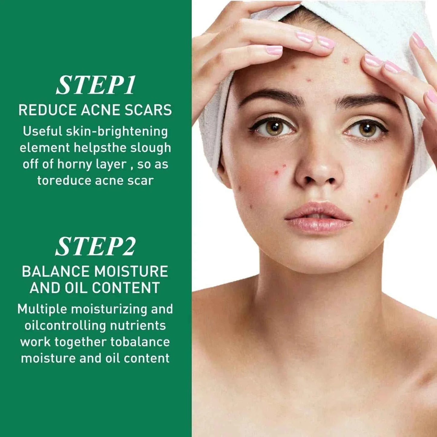 Tea Tree Oil Acne essence Attenuates Acne Print Facial fastdrop shop