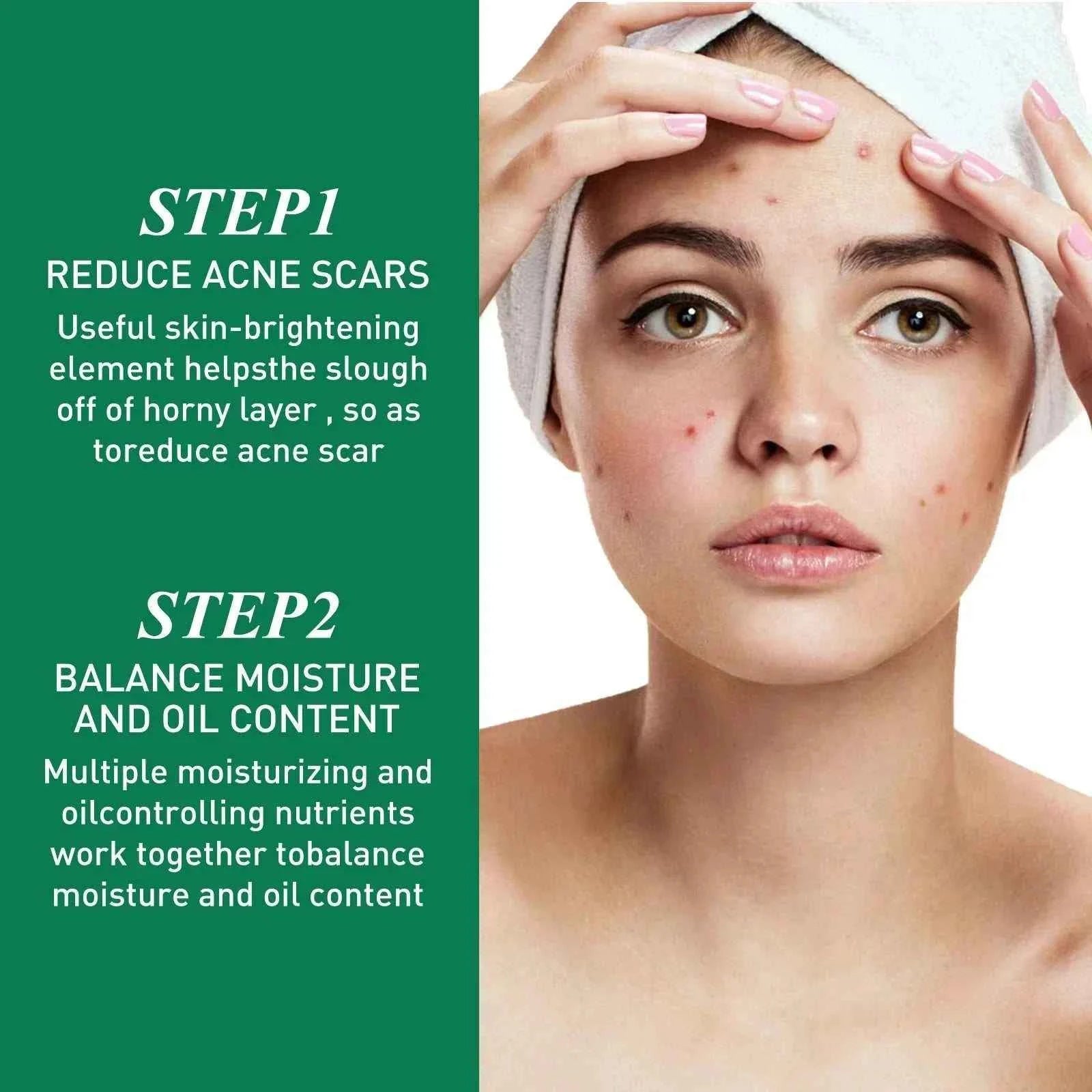 Tea Tree Oil Acne essence Attenuates Acne Print Facial fastdrop shop