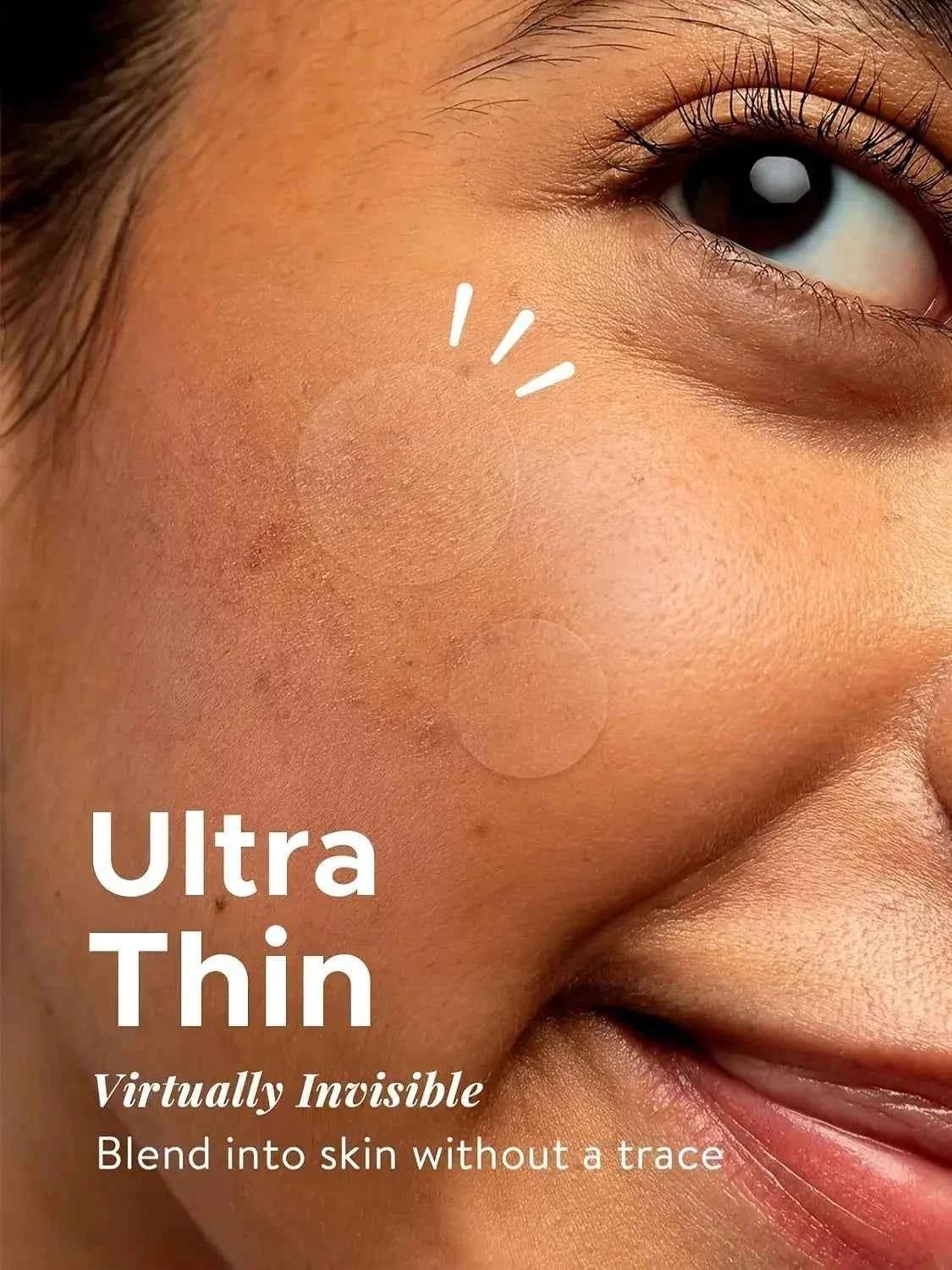 Invisible Acne Patches Set – 360 Hydrocolloid Spots